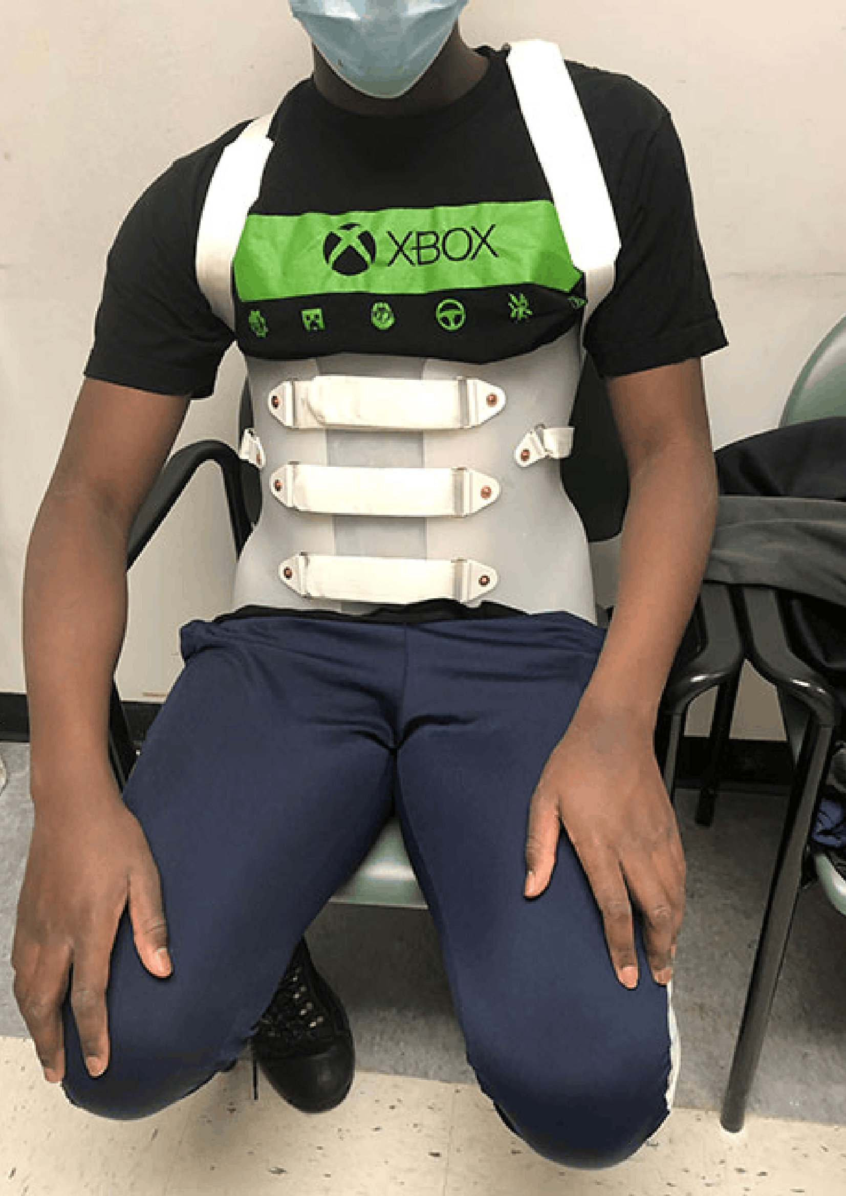 17-year-old Marcus in custom scoliosis brace